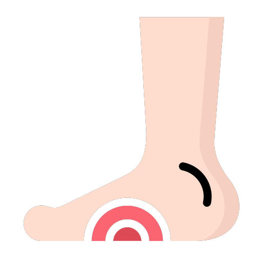 Diabetic foot
